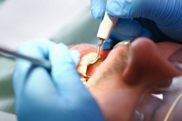 Best Emergency Dental Surgery in Elwood, KS