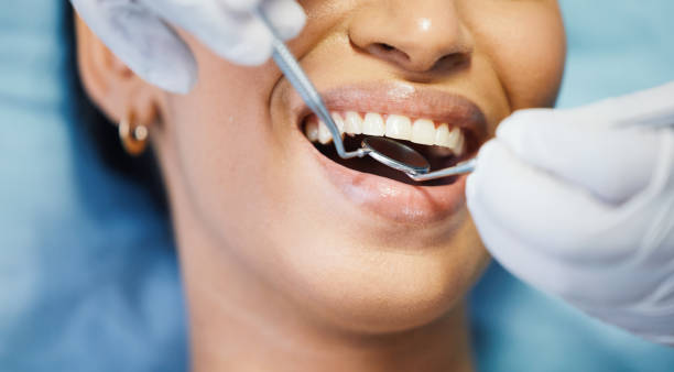 Best Emergency Broken Tooth Repair in Elwood, KS